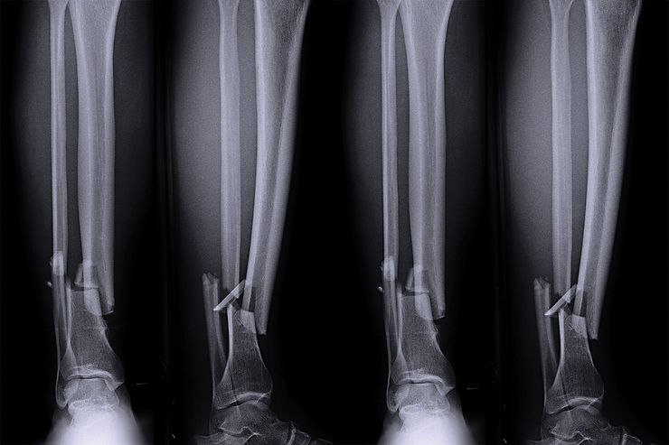 Only the Professionals Can Balance the Profession